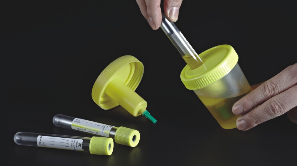 Urine Container With Needle
